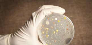 FG alerts Nigerians on outbreak of Anthrax