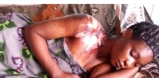 Jealousy gone wrong as food Vendor pours hot water on husband’s concubine in Ondo