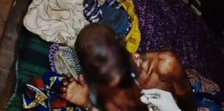 Woman sets mother ablaze in Ondo, says “pastor told me she’s behind my ordeal”